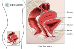 Treatment For A Leaky Bladder 2 How EM Chair treatment Stamford can help Leaky bladder issues. Read more now!