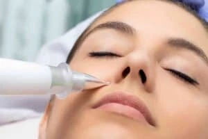 Best Actinic Keratoses Removal 3 Actinic keratoses Stamford solutions - book in today!